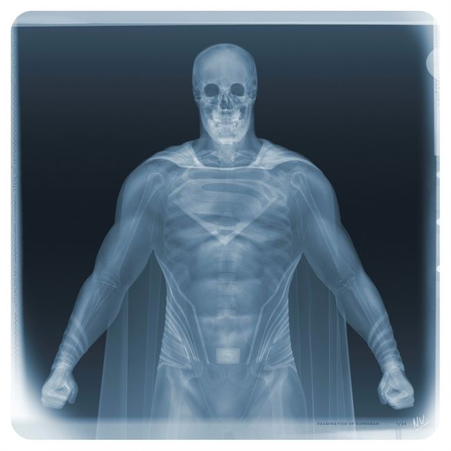 Examination of Superman by Nick Veasey contemporary artwork