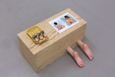 Maryam Jafri, Depression, from the series ‘Wellness-Postindustrial Complex’ (2017). Wood, silicone feet, acupuncture needles, glass cupping equipment, photograph, paper, egg carton. Courtesy the artist and Laveronica arte contemporanea.