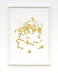 G-banding Microchimerism 46, XX + (II) by Alicia Frankovich contemporary artwork print