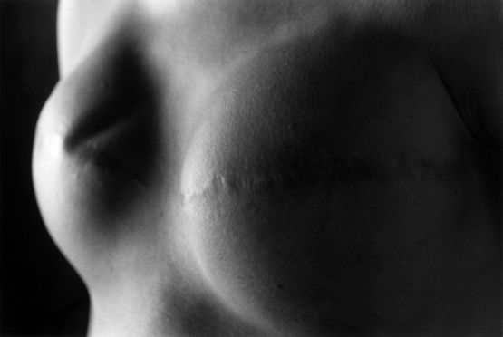 Innocence 5 by Ishiuchi Miyako contemporary artwork Photography