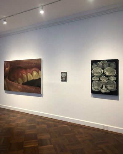 Issy Woods Textured Paintings Evoke Uncanny Aesthetics at Michael Werner