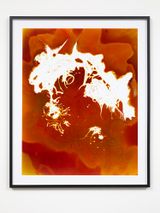 Alopecia by Justine Varga contemporary artwork photography