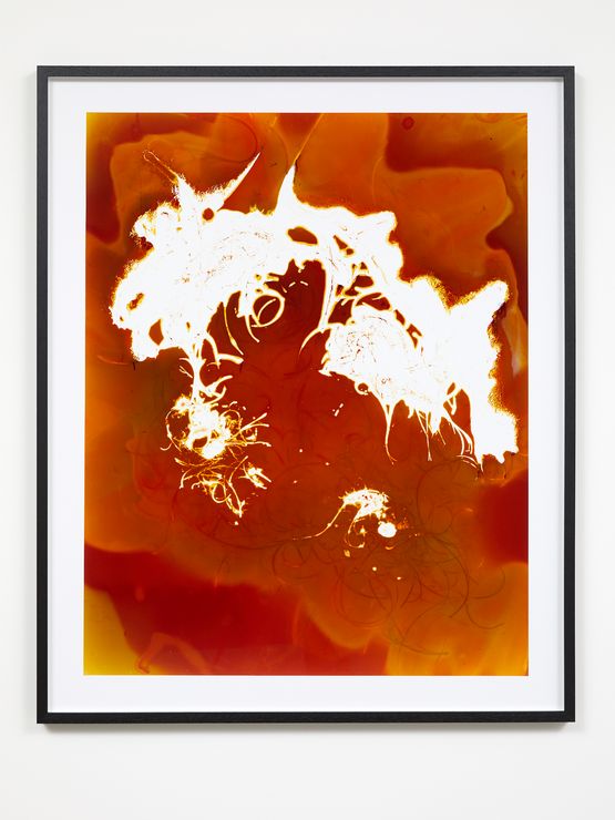 Alopecia by Justine Varga contemporary artwork Photography