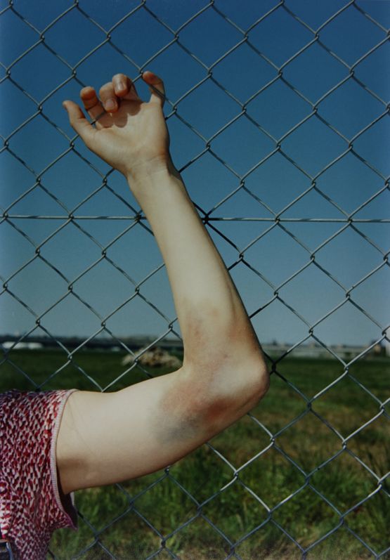 Annina bruise by Samuel Laurence Cunnane contemporary artwork Photography
