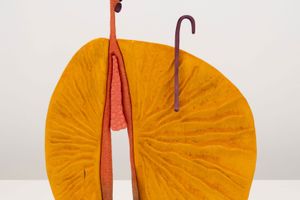 Matthew Ronay