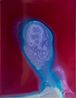 Adrenalin Dopamin by Sarah Ancelle Schonfeld contemporary artwork Photography