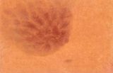 Mastitis by Eunsil Lee contemporary artwork works on paper
