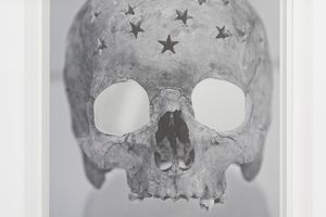 Douglas Gordon