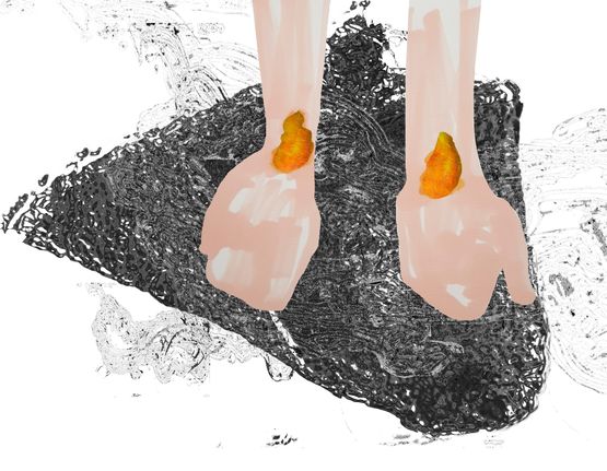 Wrists on Fire from the series Revisiting Fear by Tamara K. E. contemporary artwork Mixed Media