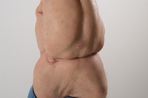 Patricia Piccinini