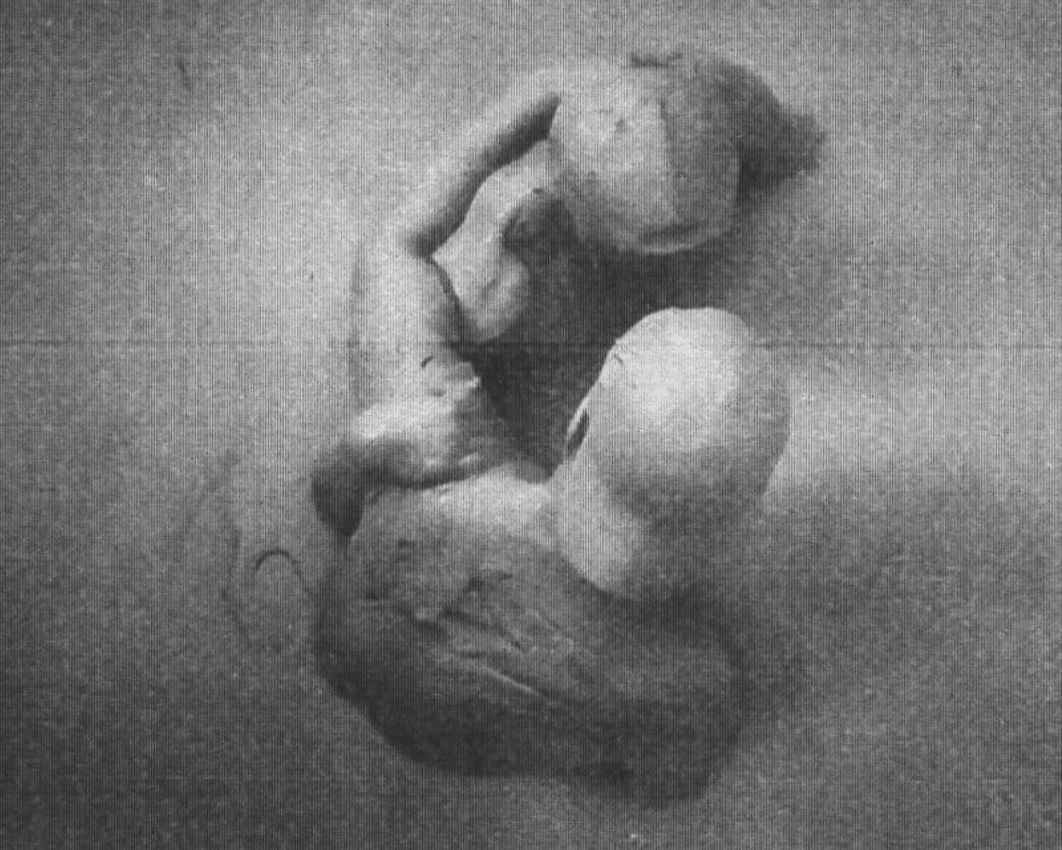 Laila Majid, Louis Blue Newby