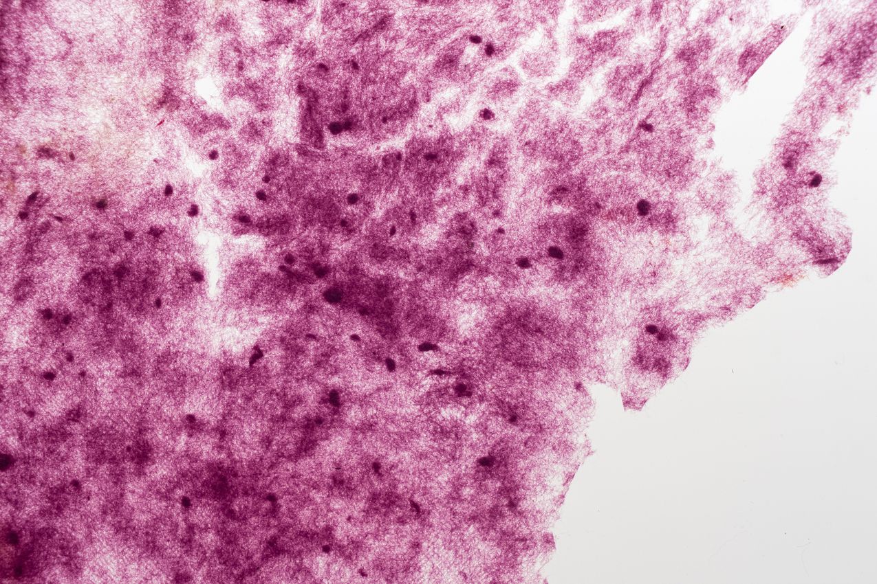 AMELIA TOLEDO